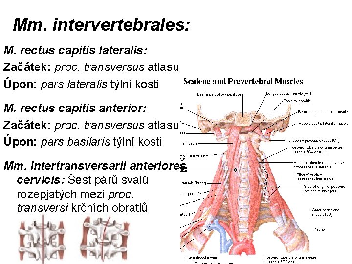 Mm. intervertebrales: M. rectus capitis lateralis: Začátek: proc. transversus atlasu Úpon: pars lateralis týlní