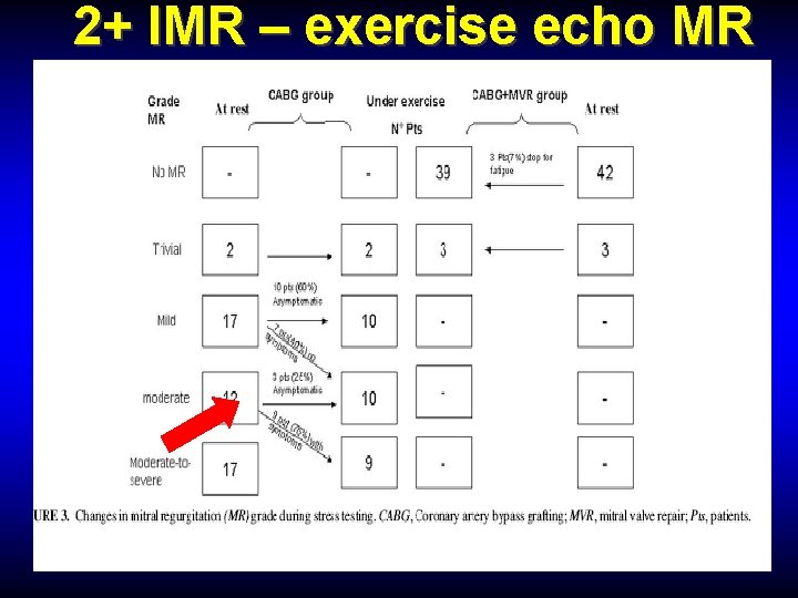 2+ IMR – exercise echo MR 