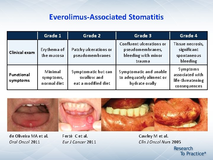 Everolimus-Associated Stomatitis Grade 1 Grade 2 Grade 3 Grade 4 Tissue necrosis, significant spontaneous Everolimus-Associated Stomatitis Grade 1 Grade 2 Grade 3 Grade 4 Tissue necrosis, significant spontaneous