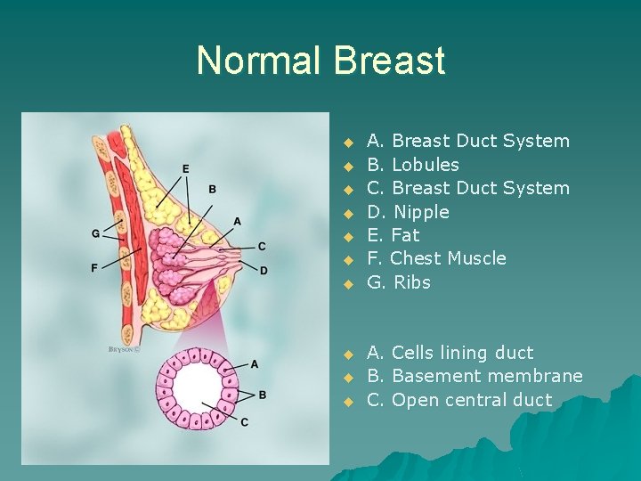 Normal Breast u u u u u A. Breast Duct System B. Lobules C.