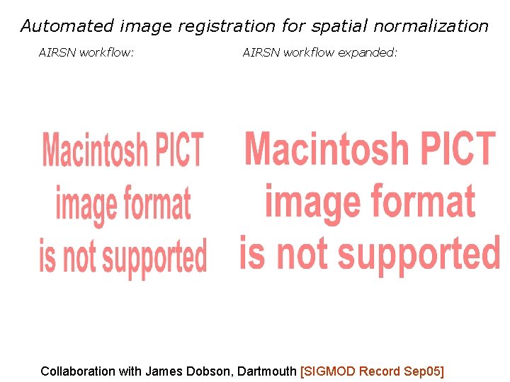 Automated image registration for spatial normalization AIRSN workflow: AIRSN workflow expanded: Collaboration with James