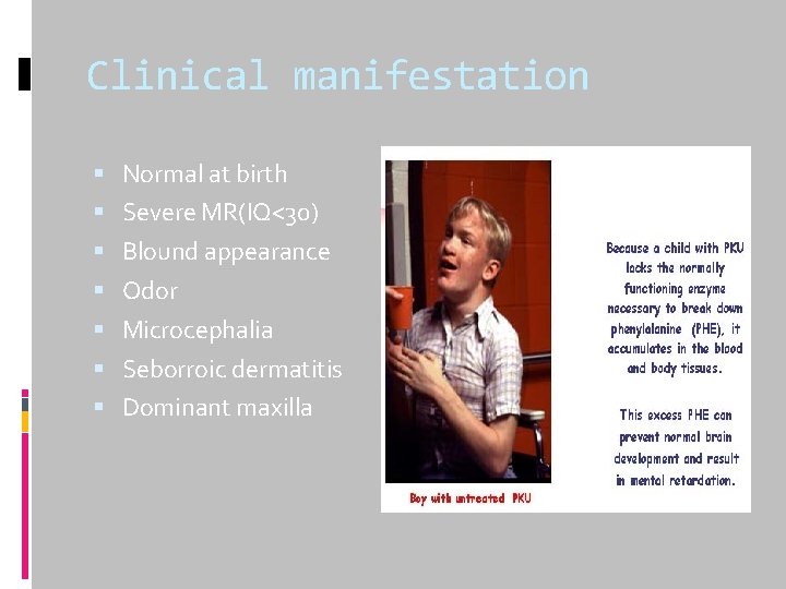 Clinical manifestation Normal at birth Severe MR(IQ<30) Blound appearance Odor Microcephalia Seborroic dermatitis Dominant