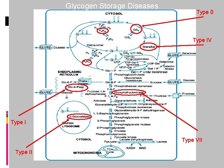 Glycogen Storage Diseases Type 0 Type IV Type I Type VII Type II 