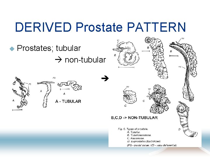 DERIVED Prostate PATTERN Prostates; tubular non-tubular u 