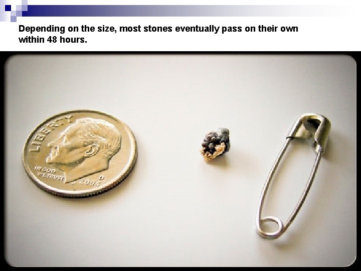 Depending on the size, most stones eventually pass on their own within 48 hours.