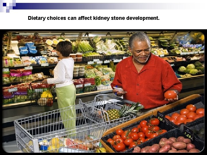 Dietary choices can affect kidney stone development. 