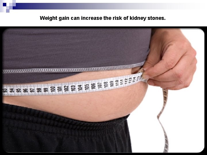 Weight gain can increase the risk of kidney stones. 