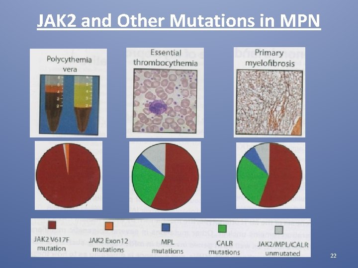 JAK 2 and Other Mutations in MPN 22 