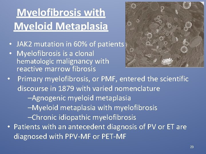 Myelofibrosis with Myeloid Metaplasia • JAK 2 mutation in 60% of patients • Myelofibrosis