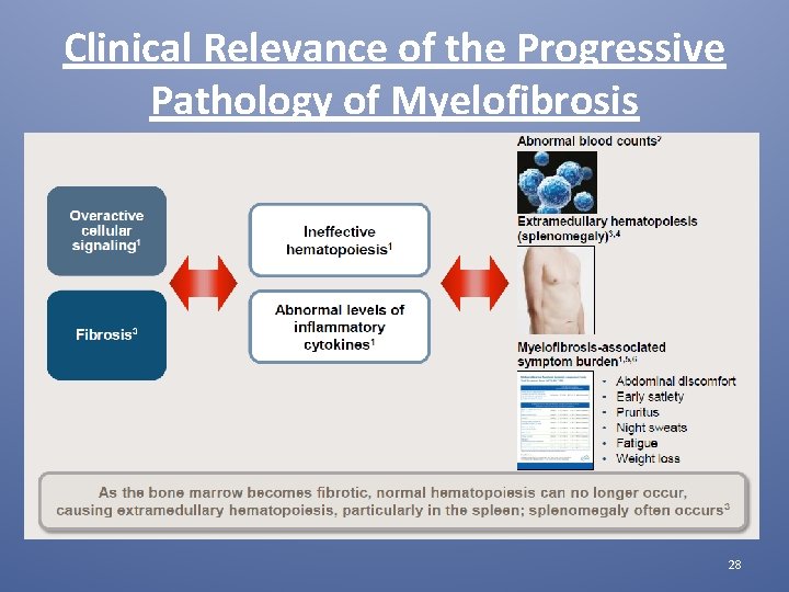 Clinical Relevance of the Progressive Pathology of Myelofibrosis 28 