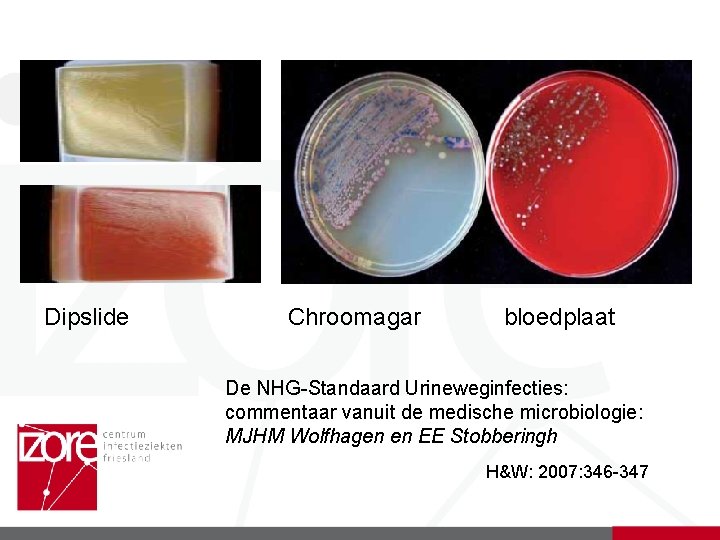 Dipslide Chroomagar bloedplaat De NHG-Standaard Urineweginfecties: commentaar vanuit de medische microbiologie: MJHM Wolfhagen en