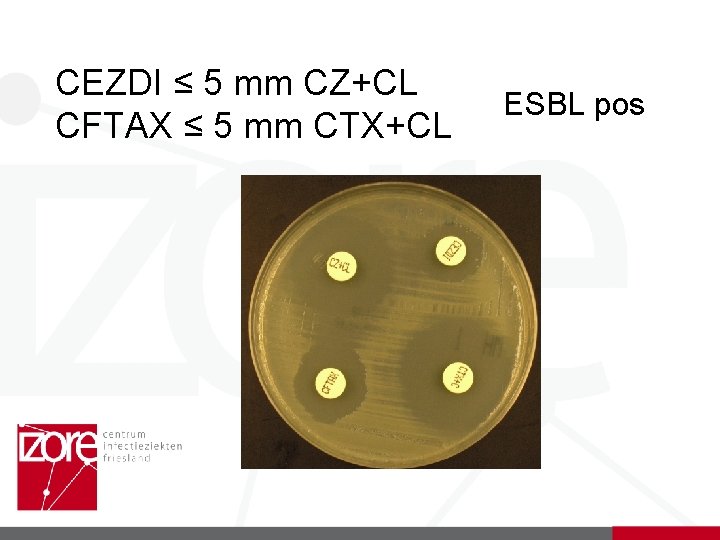 CEZDI ≤ 5 mm CZ+CL CFTAX ≤ 5 mm CTX+CL ESBL pos 
