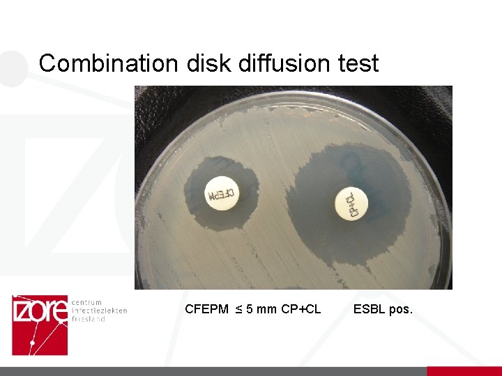 Combination disk diffusion test CFEPM ≤ 5 mm CP+CL ESBL pos. 