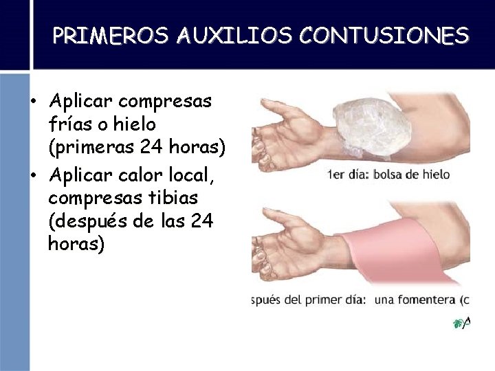 PRIMEROS AUXILIOS CONTUSIONES • Aplicar compresas frías o hielo (primeras 24 horas) • Aplicar