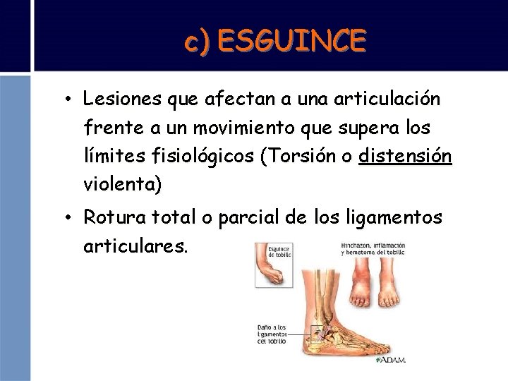 c) ESGUINCE • Lesiones que afectan a una articulación frente a un movimiento que