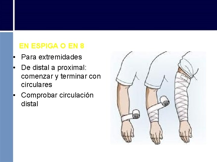 EN ESPIGA O EN 8 • Para extremidades • De distal a proximal: comenzar