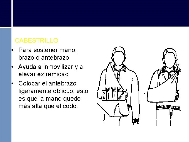 CABESTRILLO • Para sostener mano, brazo o antebrazo • Ayuda a inmovilizar y a