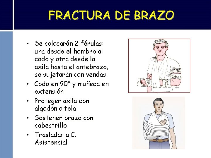 FRACTURA DE BRAZO • Se colocarán 2 férulas: una desde el hombro al codo