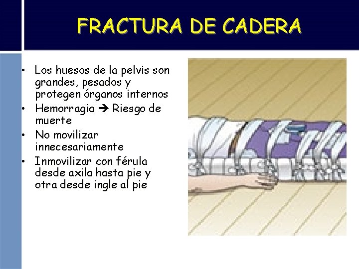 FRACTURA DE CADERA • Los huesos de la pelvis son grandes, pesados y protegen