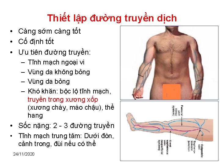 Thiết lập đường truyền dịch • Càng sớm càng tốt • Cố định tốt