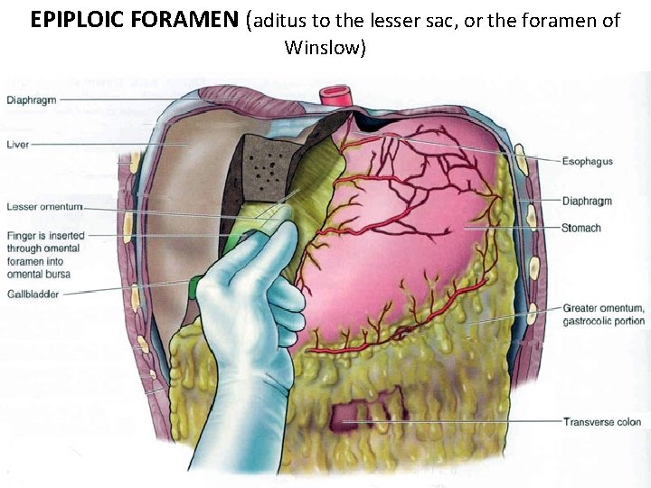 EPIPLOIC FORAMEN (aditus to the lesser sac, or the foramen of Winslow) 