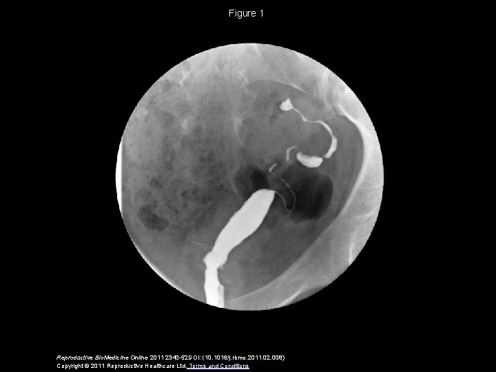 Figure 1 Reproductive Bio. Medicine Online 2011 2340 -52 DOI: (10. 1016/j. rbmo. 2011.