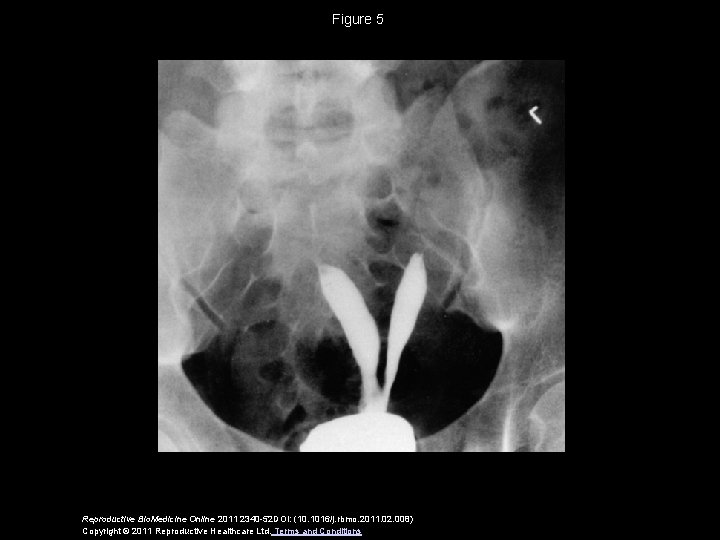 Figure 5 Reproductive Bio. Medicine Online 2011 2340 -52 DOI: (10. 1016/j. rbmo. 2011.