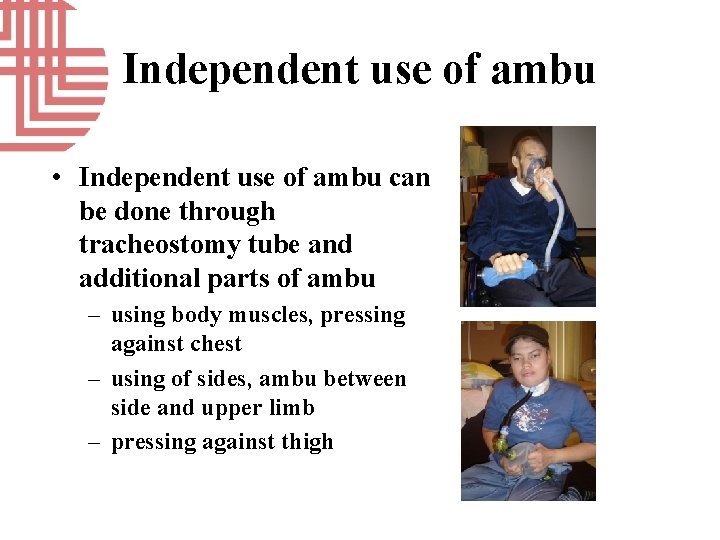 Independent use of ambu • Independent use of ambu can be done through tracheostomy