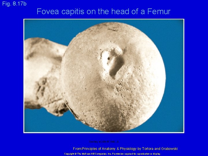 Fig. 8. 17 b Fovea capitis on the head of a Femur Courtesy of