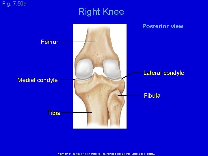 Fig. 7. 50 d Right Knee Posterior view Femur Lateral condyle Medial condyle Fibula