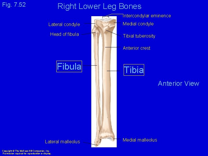 Fig. 7. 52 Right Lower Leg Bones Intercondylar eminence Lateral condyle Medial condyle Head