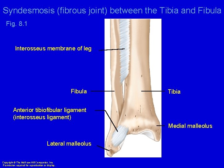 Syndesmosis (fibrous joint) between the Tibia and Fibula Fig. 8. 1 Interosseus membrane of