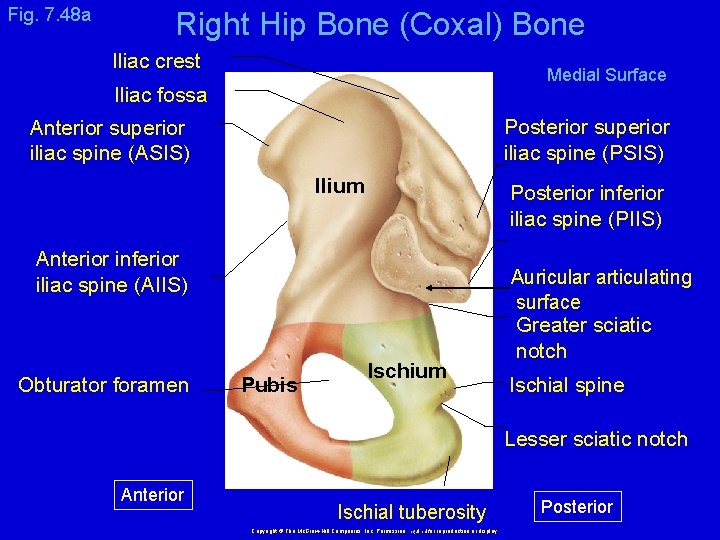 Fig. 7. 48 a Right Hip Bone (Coxal) Bone Iliac crest Medial Surface Iliac