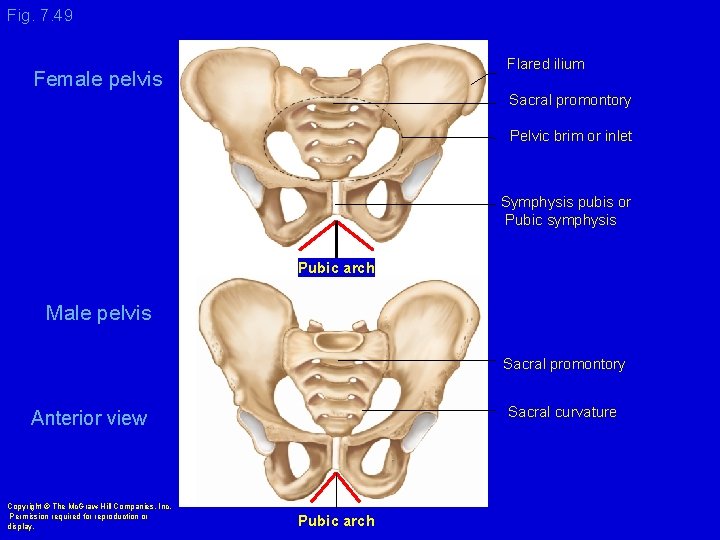 Fig. 7. 49 Flared ilium Female pelvis Sacral promontory Pelvic brim or inlet Symphysis