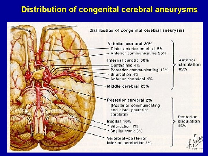 Distribution of congenital cerebral aneurysms 