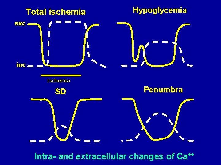 Úplná ischémia Total ischemia Hypoglycemia exc inc Ischemia SD Penumbra Intra- and extracellular changes