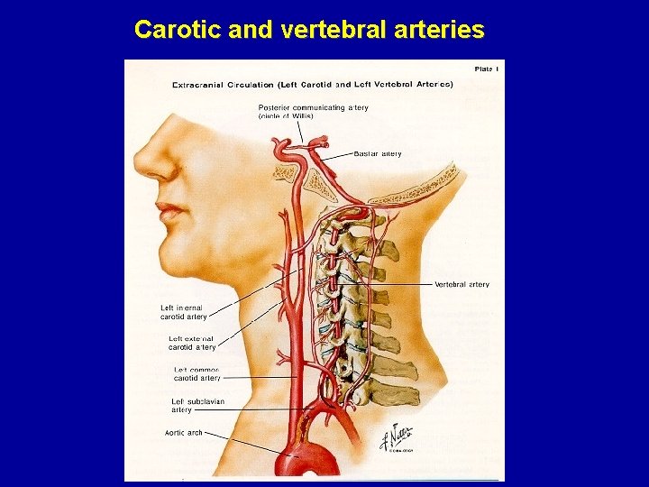 Carotic and vertebral arteries 