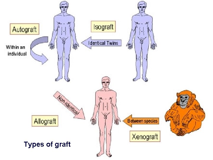  Types of graft 