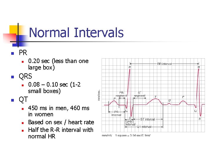 Normal Intervals n PR n n QRS n n 0. 20 sec (less than
