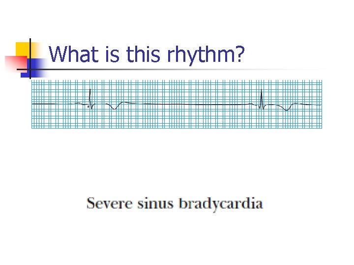 What is this rhythm? What is this rhythm?