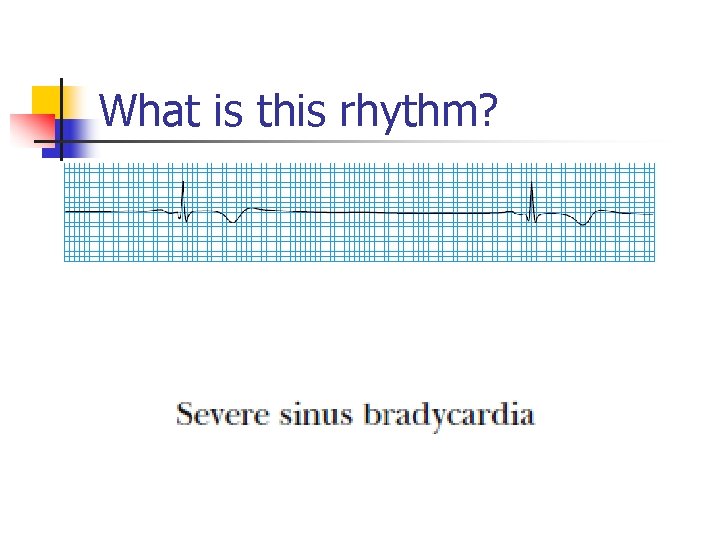 What is this rhythm? 