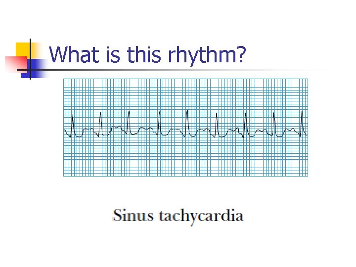 What is this rhythm? 