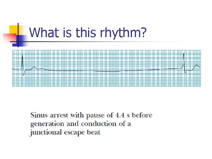 What is this rhythm? 