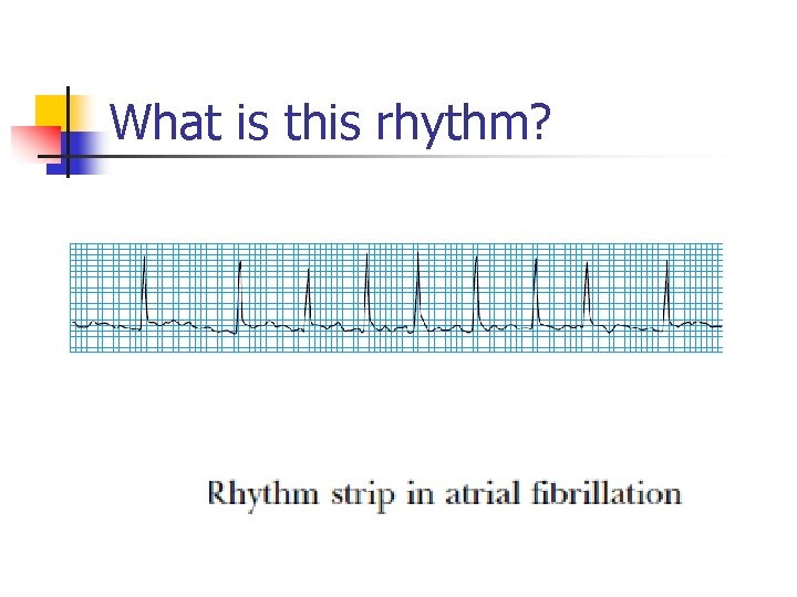 What is this rhythm? 