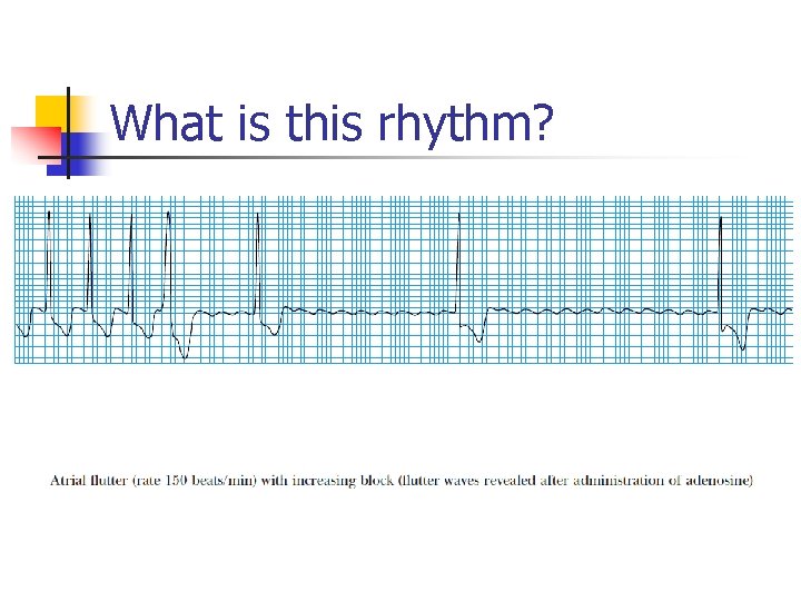 What is this rhythm? 