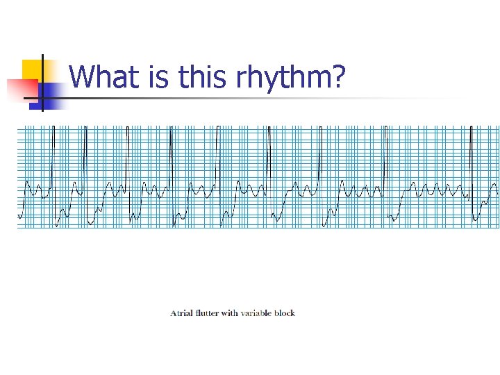 What is this rhythm? 