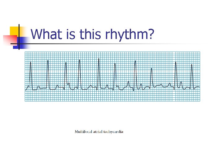 What is this rhythm? 