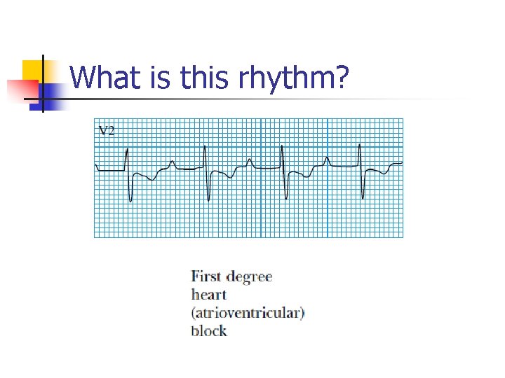 What is this rhythm? 