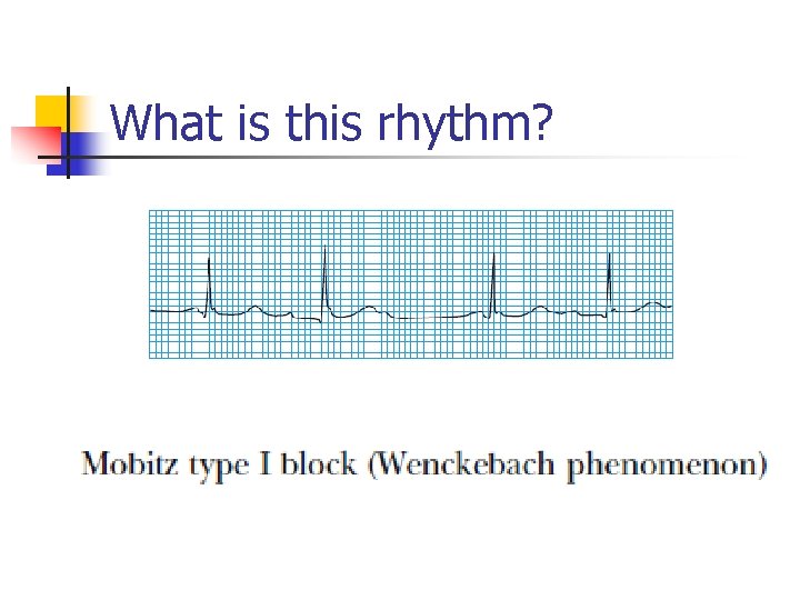 What is this rhythm? 