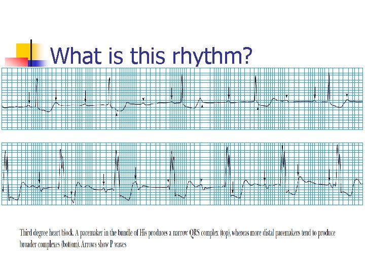 What is this rhythm? 